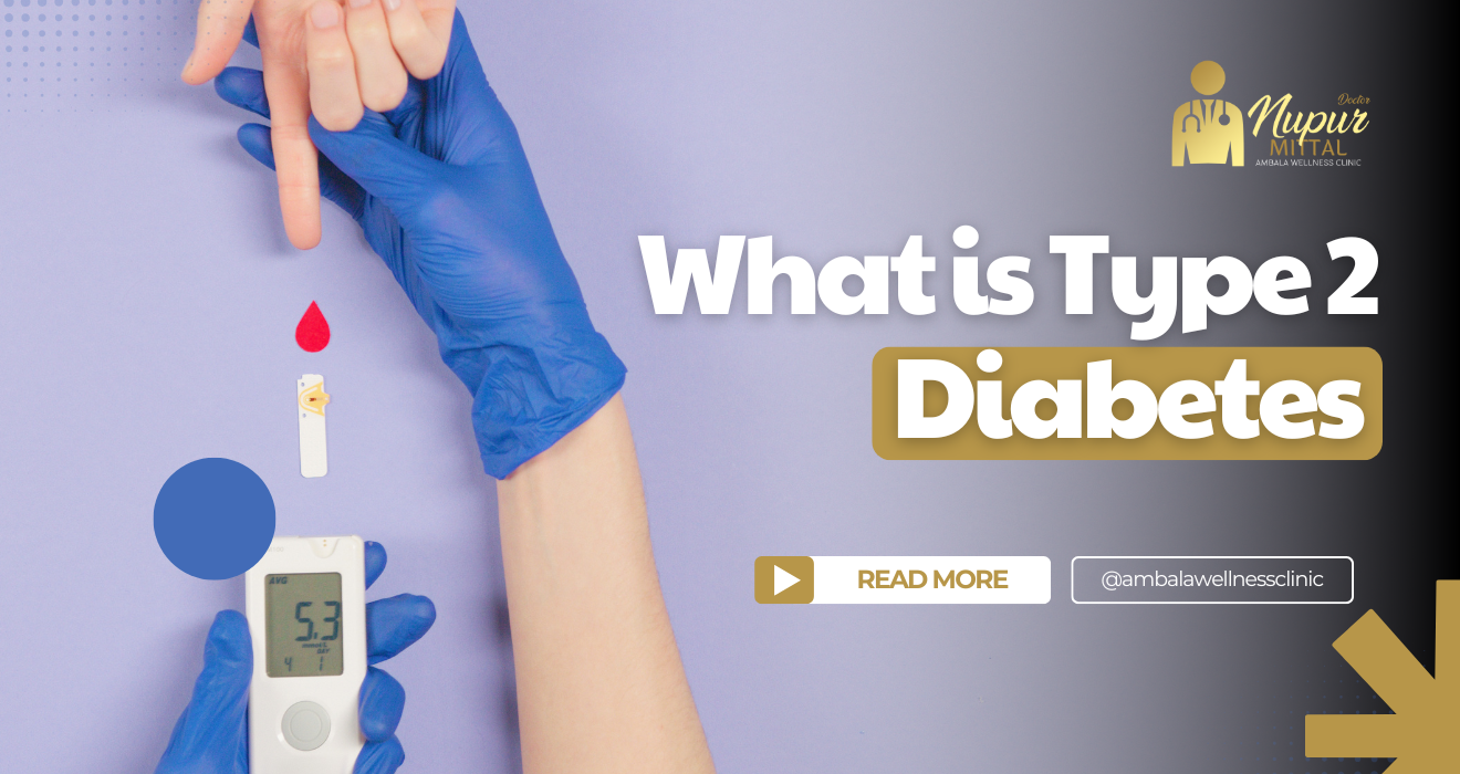 Type 2 Diabetes